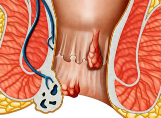 ����� ��� �������� ����