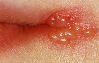 ������ �� �����