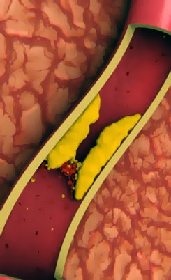 ������������������ ����� ����