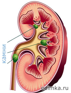 ����� ��� ������������ �������  ����