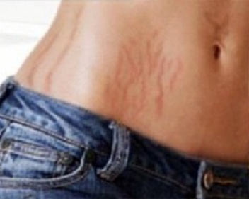 ����������� �� �������� ����� ����� � �������� ��������