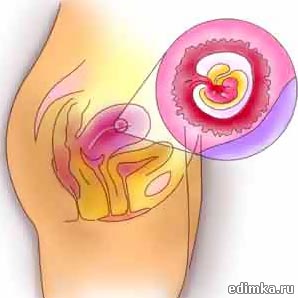 4 ������ ������������ ����