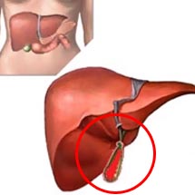 ������� ������, ����� ��� ����������� �������� ������ ����